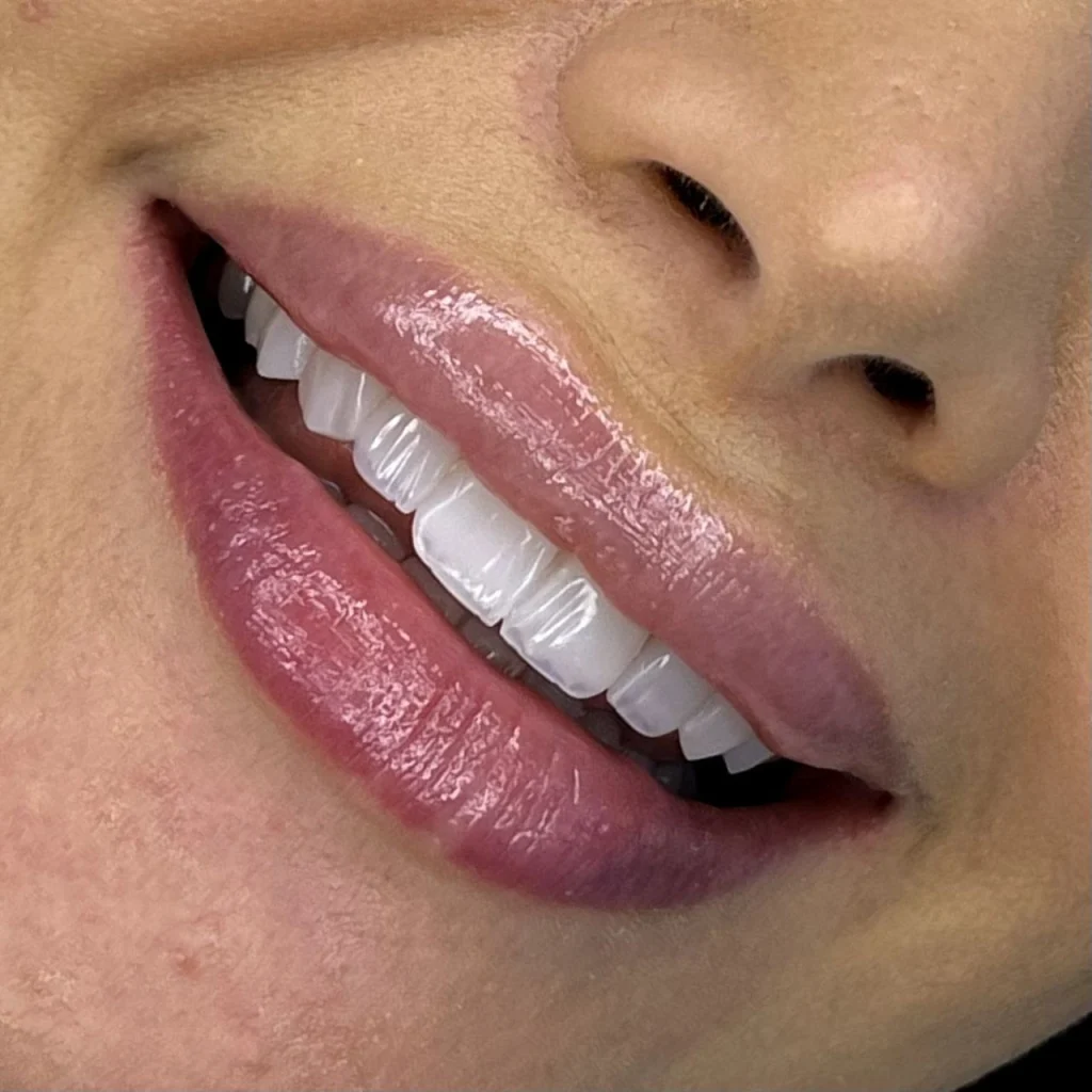 طراحی خط لبخند کلینیک دکتر سپیده سحرگشا