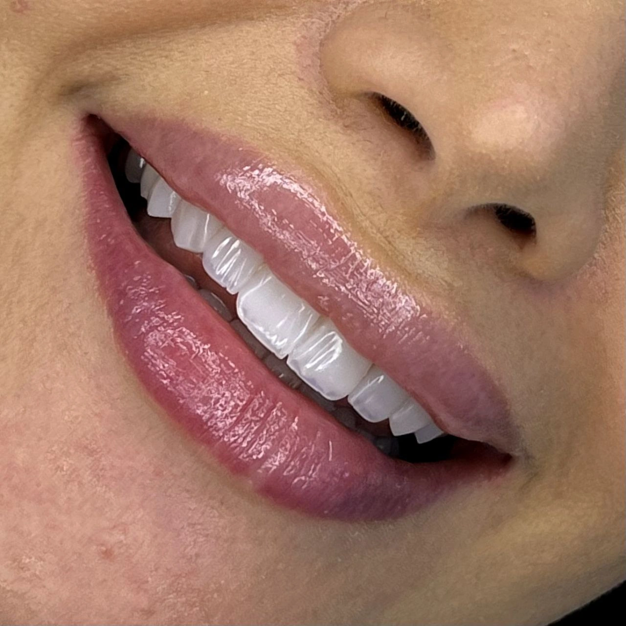 طراحی خط لبخند کلینیک دکتر سپیده سحرگشا